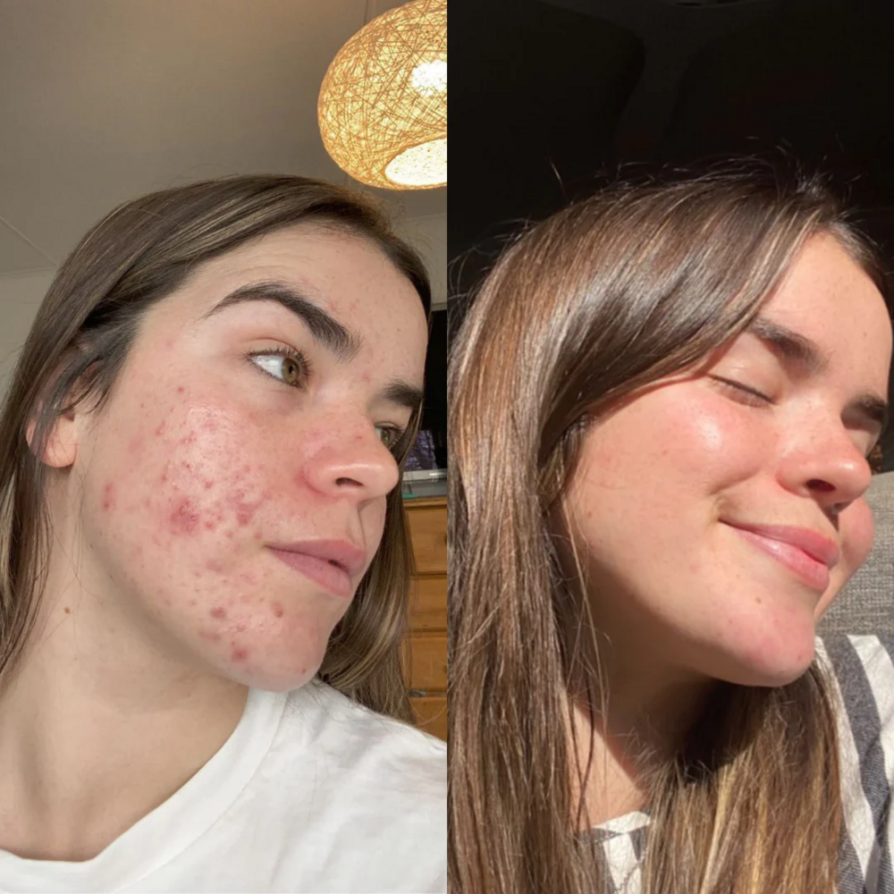 Eco by Sonya, Glory Oil, naturlig, ekologisk, vegansk, kroppsolja, ansiktsolja, skyddar, läker, minskar synligheten av ärr och rynkor.