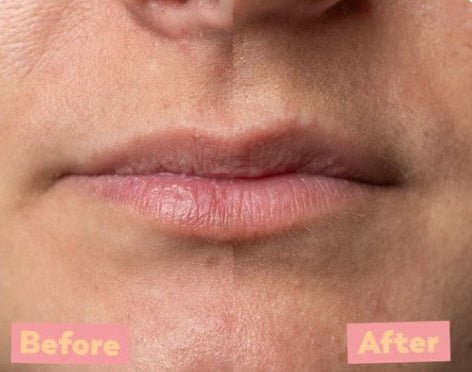 Läppeeling före och efter